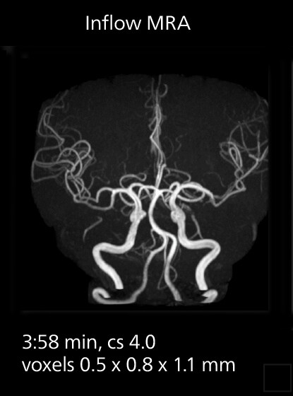 Brain mri three