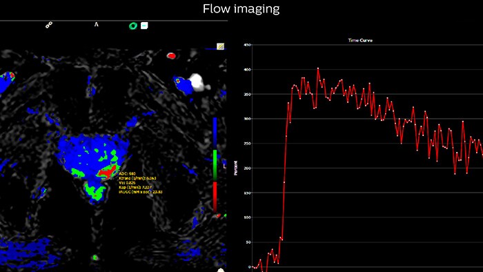 Flow imaging