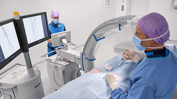 Mobile C-arms for vascular