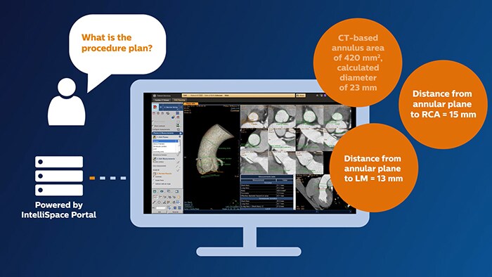 Cardiovascular image video thumbnail